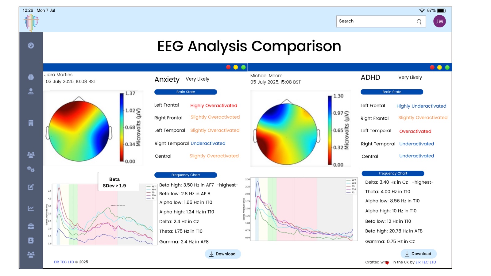 EEG analysis comparison view in the EIR TEC dashboard