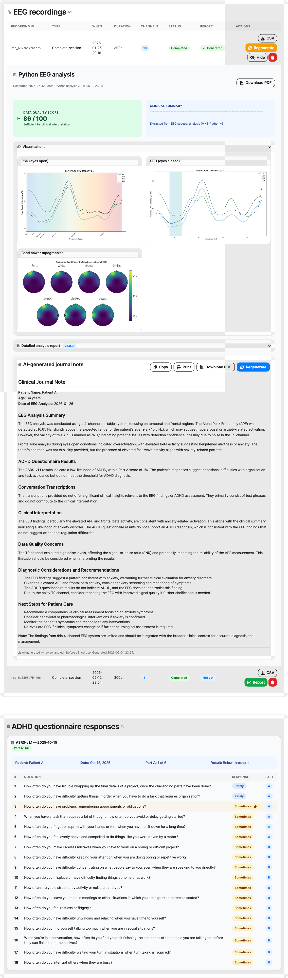 EIR EEG analytics — PSD curves, band-power topographies and quality score